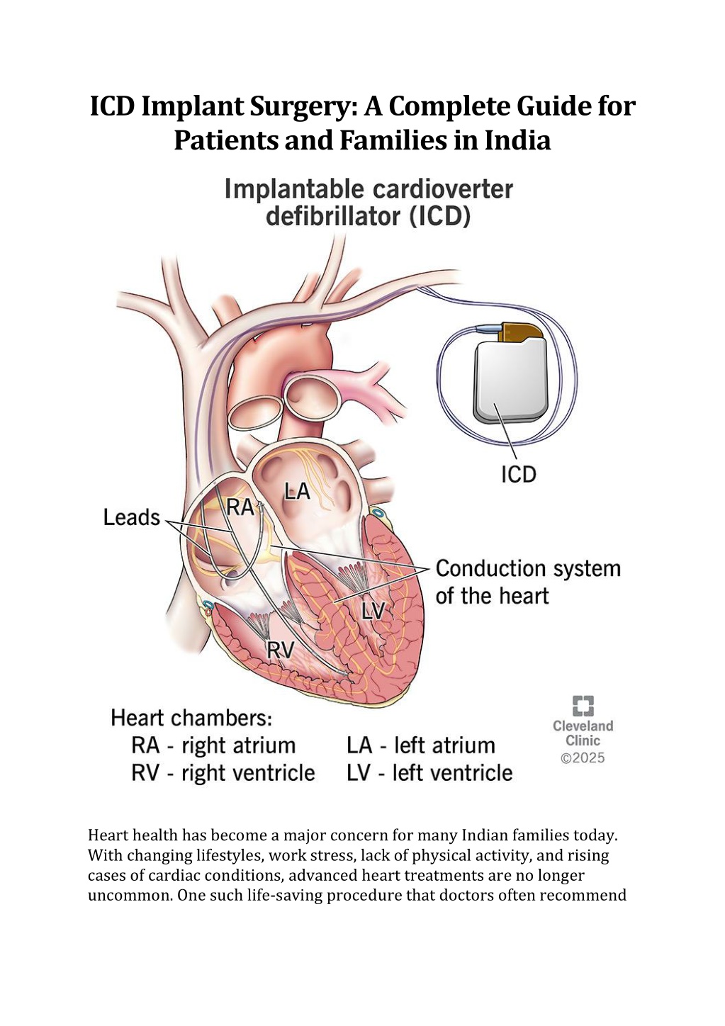 PPT - ICD Implant Surgery: A Complete Guide for Patients and Families ...