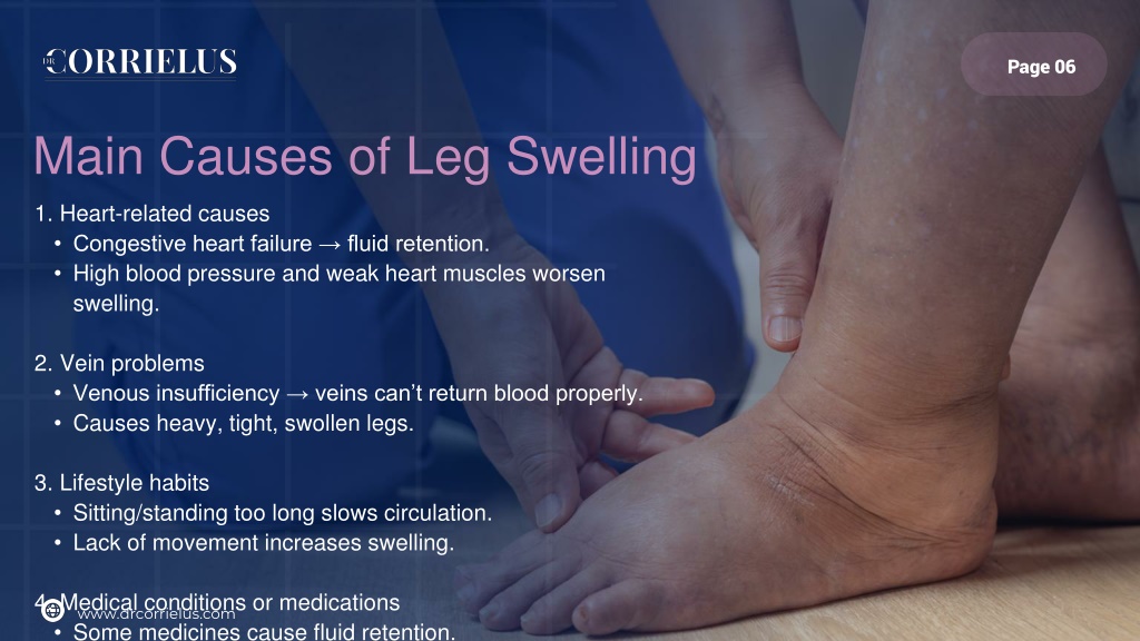 Heart Problems Leg Rash PPT - Understanding Leg Swelling & Its Link to Heart Failure PowerPoint ...