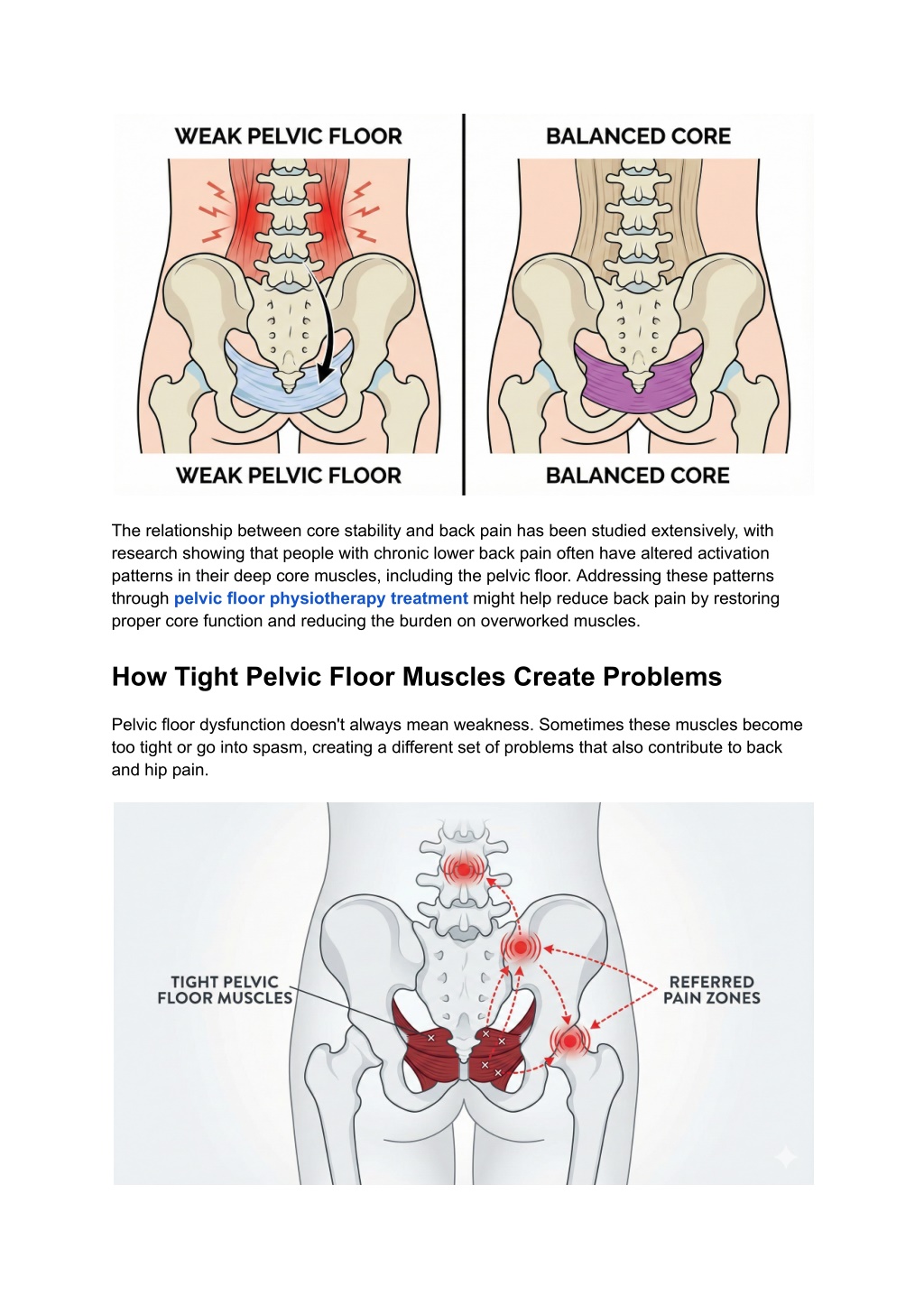 PPT - How Pelvic Floor Dysfunction Affects Back and Hip Pain ...
