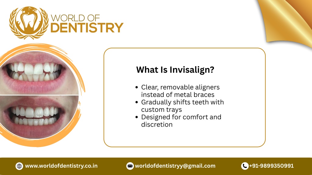 PPT - Invisalign Treatment Timeline How Long Does Teeth Straightening ...
