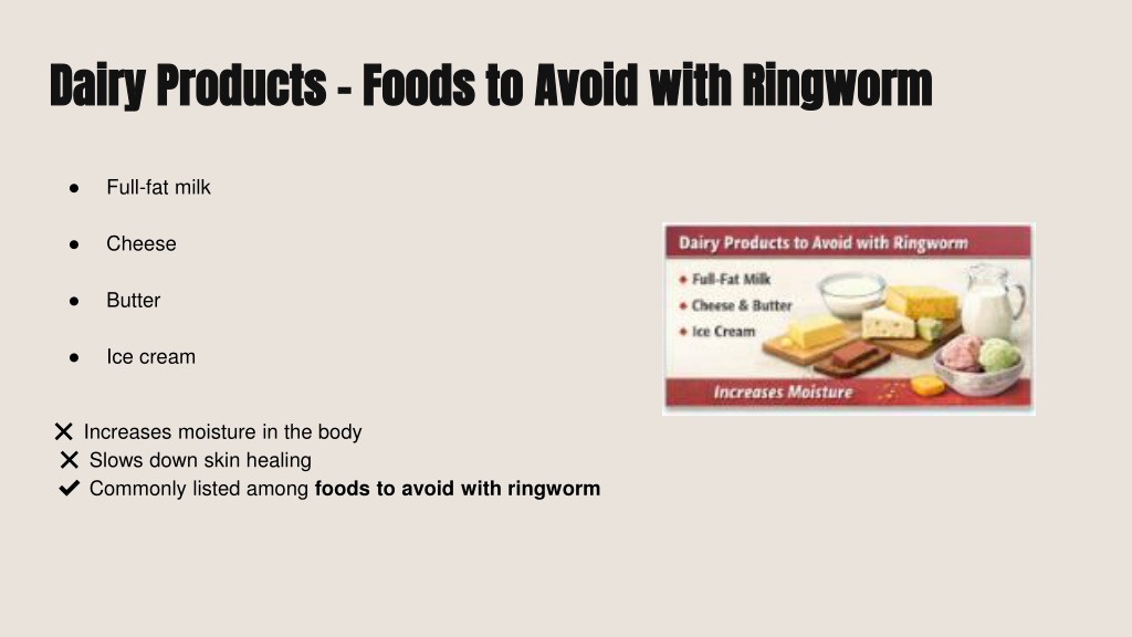 PPT - Ringworm Diet: Foods to Eat & Avoid for Ringworm Infection ...