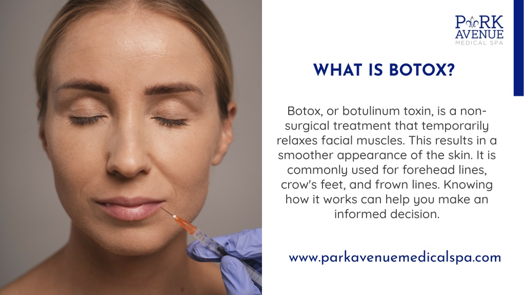 PPT - Exploring Local Options for Cosmetic Botox A Comprehensive Guide ...