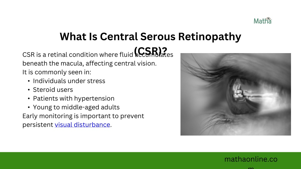 PPT - Holistic CSR Eye Ayurvedic Treatment Approach PowerPoint ...