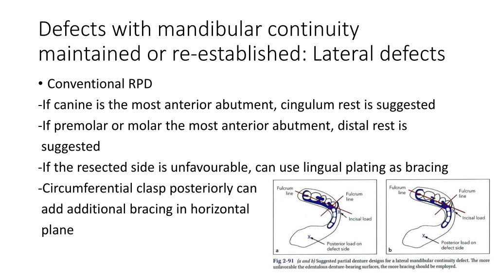 PPT - REHABILITATION OF TONGUE AND MANDIBULAR DEFECTS - FINAL ...