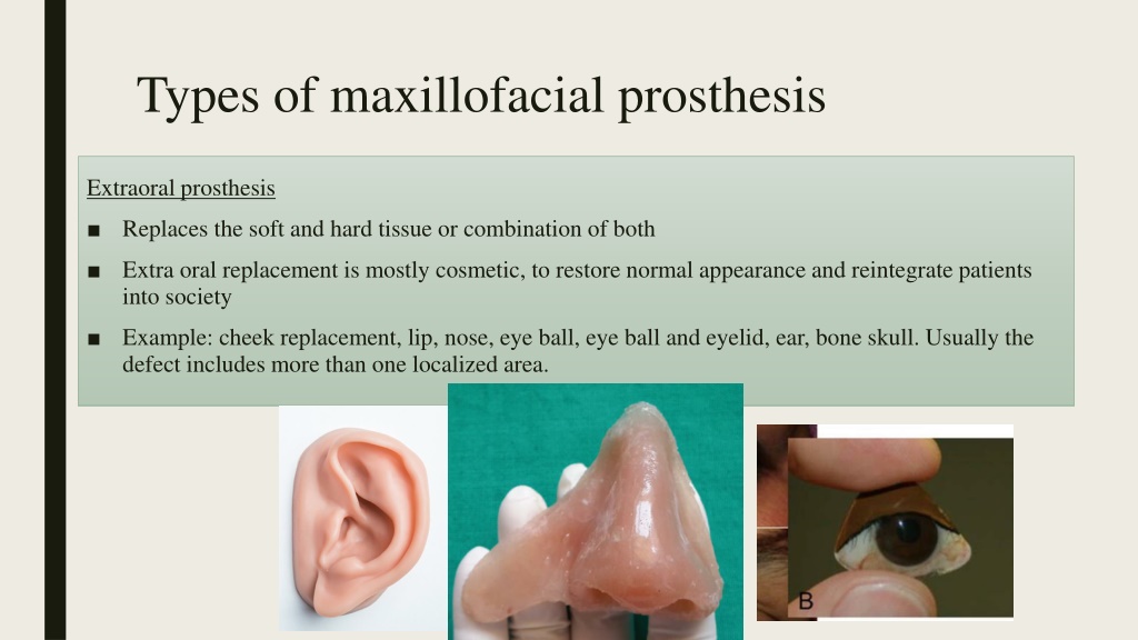 PPT - Maxillofacial module PowerPoint Presentation, free download - ID ...